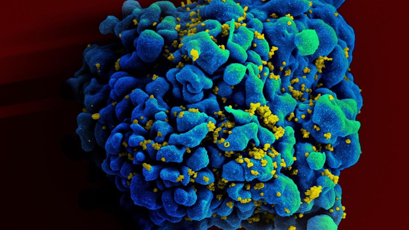 Promising News in the Race to Cure HIV: The Story of the First Black Woman from Africa Potentially Cured
