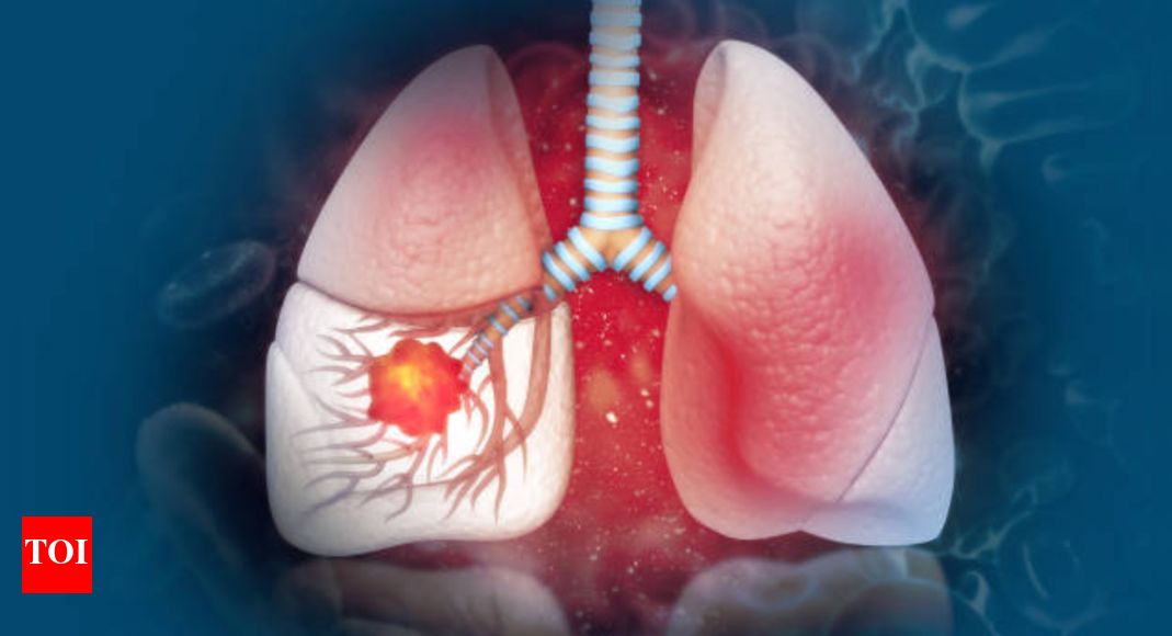 the hidden dangers of secondhand smoke3a a growing lung cancer risk