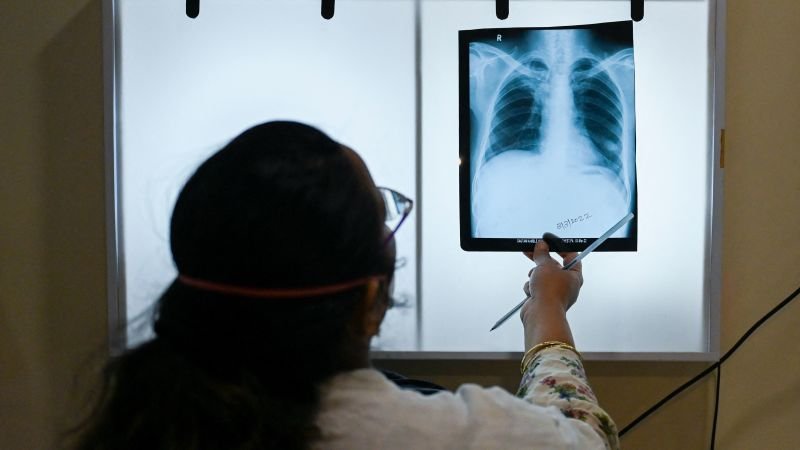 indias efforts to eliminate tb threatened amid national health care crisis
