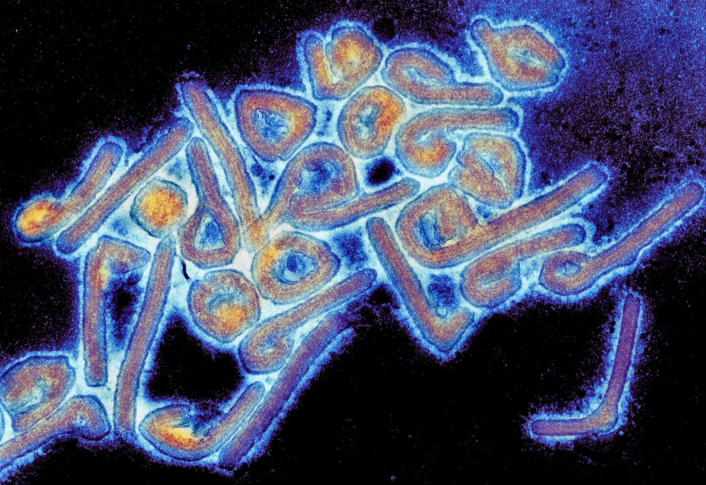 Ethiopia Confirms Outbreak of Deadly Marburg Virus, Africa CDC Reports