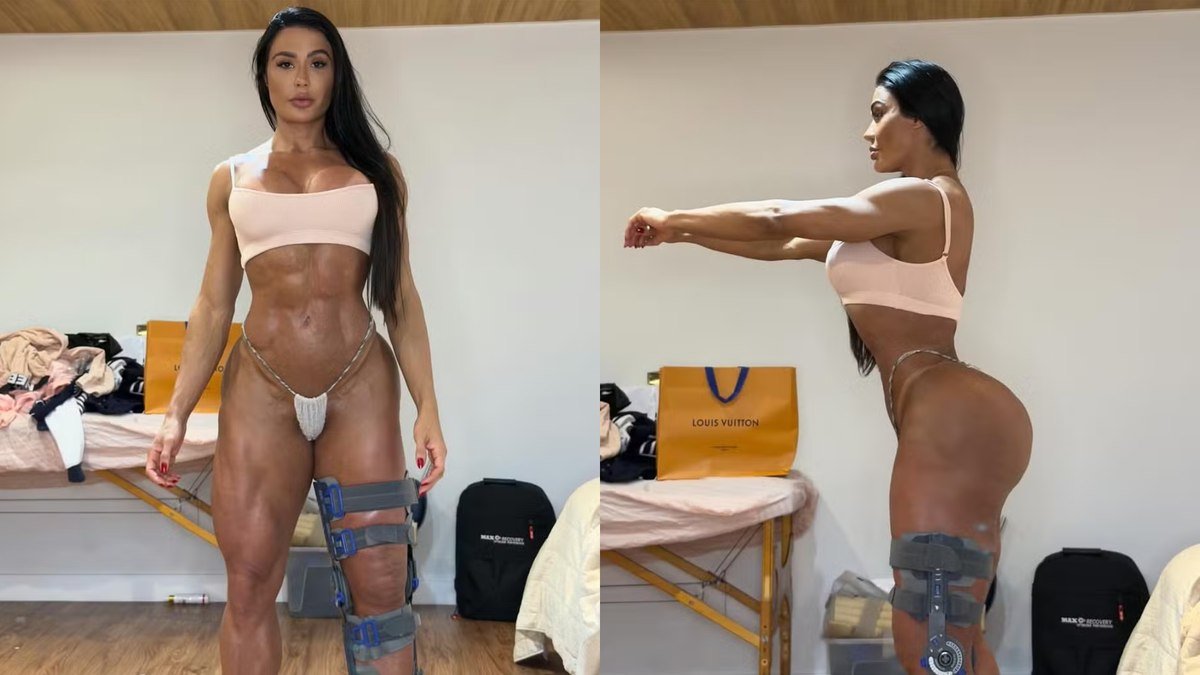 Gracyanne Barbosa shows off her body after injury on ‘Dancing with the Stars’